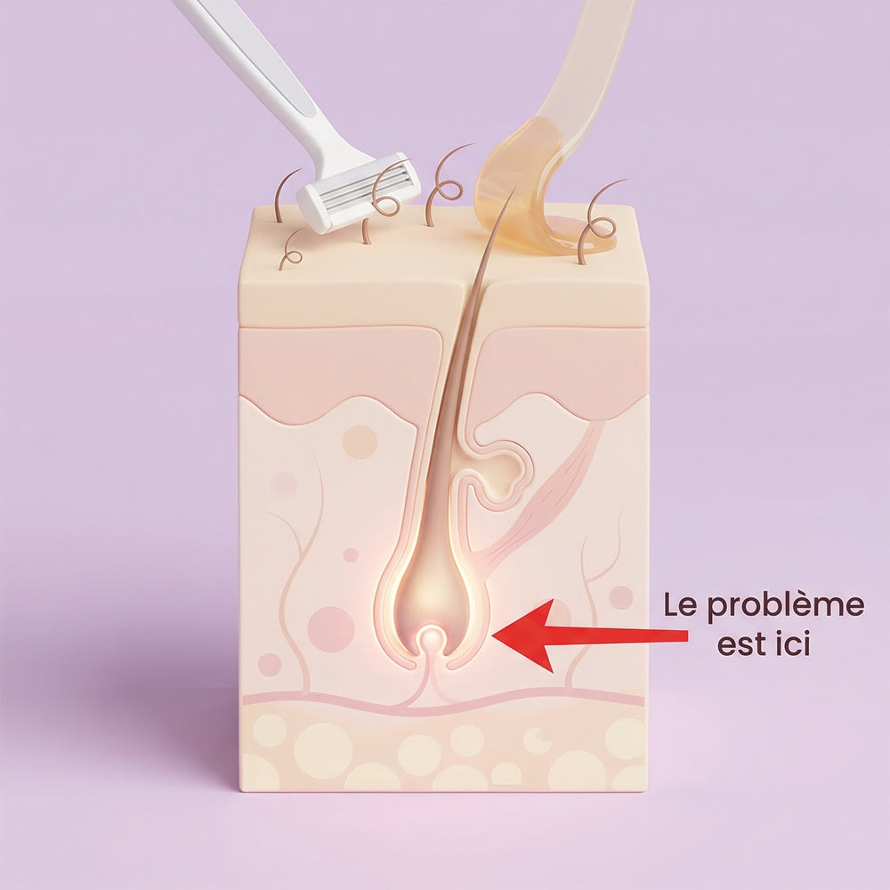 2. Cire, rasoir, crème dépilatoire… elles coupent le symptôme, jamais le message hormonal